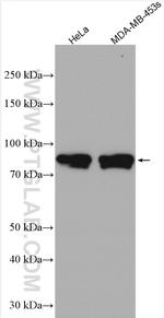 ARHGAP18 Antibody in Western Blot (WB)