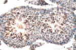 ORAI1 Antibody in Immunohistochemistry (Paraffin) (IHC (P))