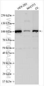 Cdkn2a/p16INK4a Antibody in Western Blot (WB)