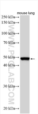 ILT-3/LILRB4 Antibody in Western Blot (WB)