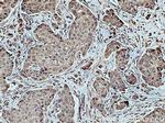 FBXW7 Antibody in Immunohistochemistry (Paraffin) (IHC (P))