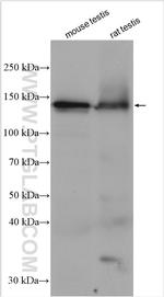 CCDC171 Antibody in Western Blot (WB)
