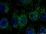 DST Antibody in Immunocytochemistry (ICC/IF)