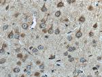 DST Antibody in Immunohistochemistry (Paraffin) (IHC (P))