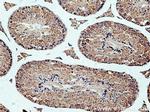 IFT172 Antibody in Immunohistochemistry (Paraffin) (IHC (P))