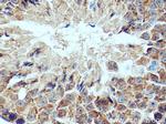 IFT172 Antibody in Immunohistochemistry (Paraffin) (IHC (P))