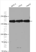 RNF160 Antibody in Western Blot (WB)