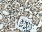 SGK1 Antibody in Immunohistochemistry (Paraffin) (IHC (P))