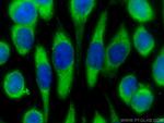 HPF1 Antibody in Immunocytochemistry (ICC/IF)