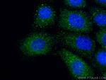 Involucrin Antibody in Immunocytochemistry (ICC/IF)