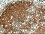Involucrin Antibody in Immunohistochemistry (Paraffin) (IHC (P))