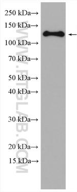 Involucrin Antibody in Western Blot (WB)
