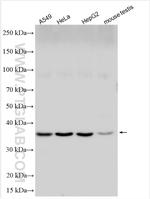 DCPS Antibody in Western Blot (WB)