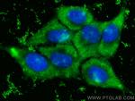 STEAP3 Antibody in Immunocytochemistry (ICC/IF)