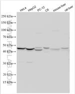 STEAP3 Antibody in Western Blot (WB)