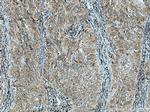GRP Antibody in Immunohistochemistry (Paraffin) (IHC (P))