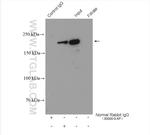 BRD4 Antibody in Immunoprecipitation (IP)