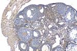 DDIT4L Antibody in Immunohistochemistry (Paraffin) (IHC (P))
