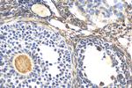 DDIT4L Antibody in Immunohistochemistry (Paraffin) (IHC (P))