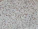 CRBN Antibody in Immunohistochemistry (Paraffin) (IHC (P))