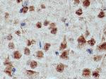 CRBN Antibody in Immunohistochemistry (Paraffin) (IHC (P))