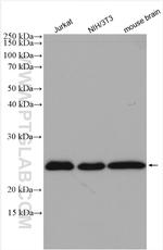 RAB11B Antibody in Western Blot (WB)