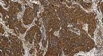 HSPA14 Antibody in Immunohistochemistry (Paraffin) (IHC (P))