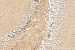 SCN8A Antibody in Immunohistochemistry (Paraffin) (IHC (P))