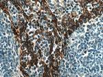 Cytokeratin 5 Antibody in Immunohistochemistry (Paraffin) (IHC (P))