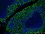 Cytokeratin 5 Antibody in Immunohistochemistry (PFA fixed) (IHC (PFA))