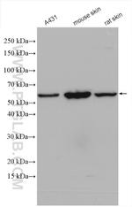 Cytokeratin 5 Antibody in Western Blot (WB)