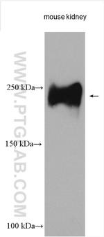 THSD7A Antibody in Western Blot (WB)