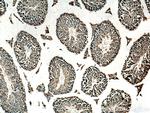 PRKDC Antibody in Immunohistochemistry (Paraffin) (IHC (P))