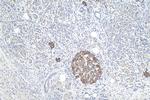 Midkine Antibody in Immunohistochemistry (Paraffin) (IHC (P))