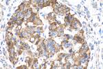 Midkine Antibody in Immunohistochemistry (Paraffin) (IHC (P))