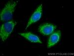 Alpha-2-antiplasmin Antibody in Immunocytochemistry (ICC/IF)