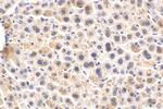 Alpha-2-antiplasmin Antibody in Immunohistochemistry (Paraffin) (IHC (P))