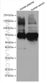 Alpha-2-antiplasmin Antibody in Western Blot (WB)