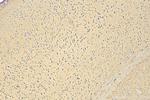 GRIK5 Antibody in Immunohistochemistry (Paraffin) (IHC (P))