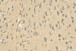 GRIK5 Antibody in Immunohistochemistry (Paraffin) (IHC (P))