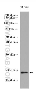 RSPO4 Antibody in Western Blot (WB)