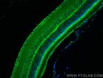MYO3A Antibody in Immunohistochemistry (PFA fixed) (IHC (PFA))