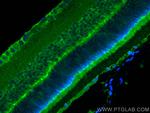 MYO3A Antibody in Immunohistochemistry (PFA fixed) (IHC (PFA))