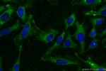 MATN1 Antibody in Immunocytochemistry (ICC/IF)