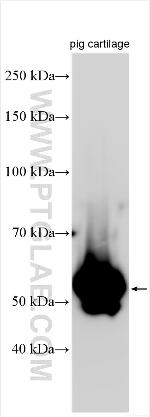 MATN1 Antibody in Western Blot (WB)
