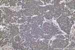 HCFC1 Antibody in Immunohistochemistry (Paraffin) (IHC (P))