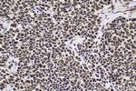 HCFC1 Antibody in Immunohistochemistry (Paraffin) (IHC (P))