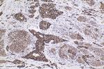 HCFC1 Antibody in Immunohistochemistry (Paraffin) (IHC (P))