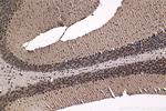 HCFC1 Antibody in Immunohistochemistry (Paraffin) (IHC (P))