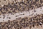 HCFC1 Antibody in Immunohistochemistry (Paraffin) (IHC (P))
